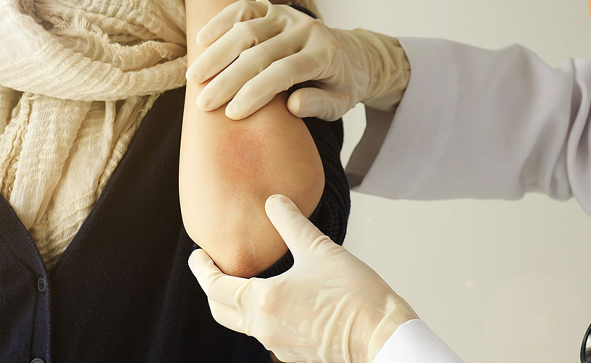 Documents-for-healthcare-professionals--AFATINIB-PATIENT-CARE-MANUAL