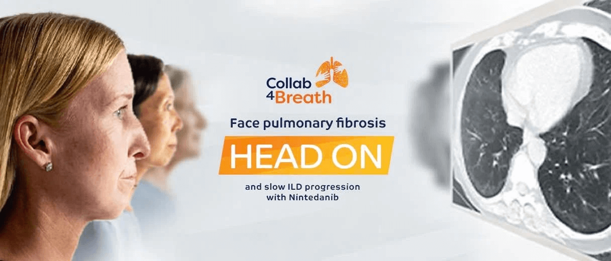 Banner Head on_carousel